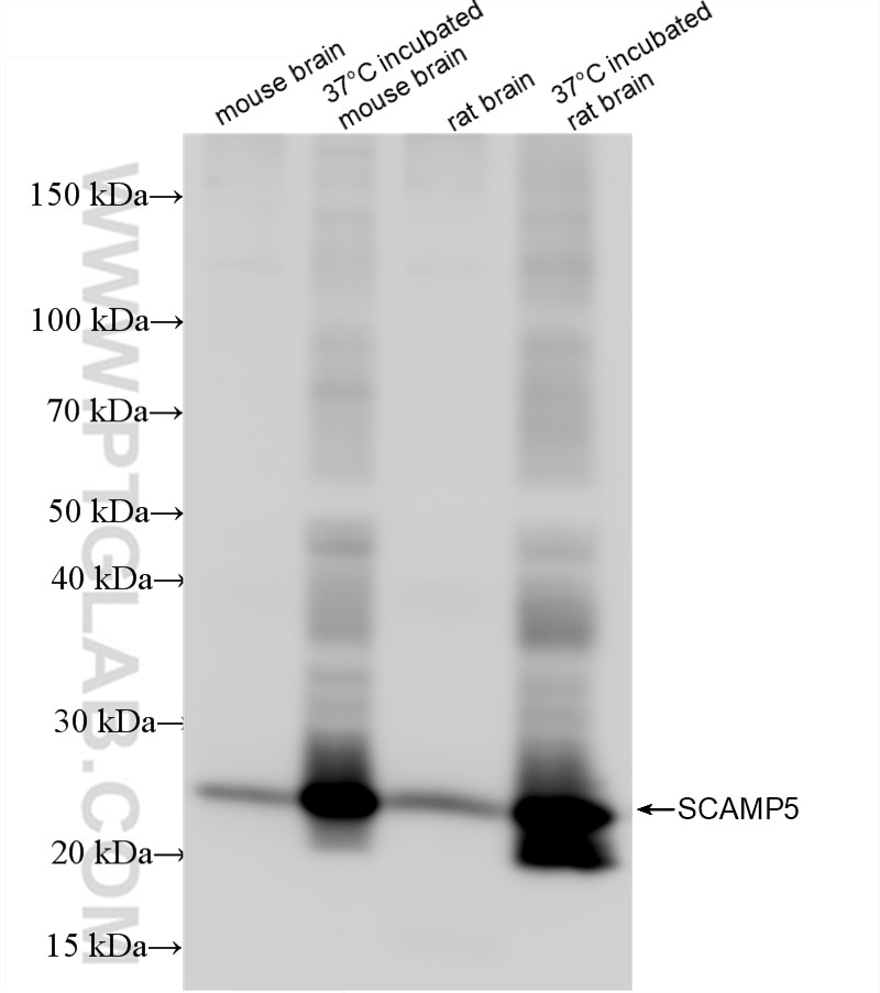 Western Blot (WB) analysis of various lysates using SCAMP5 Recombinant antibody (85669-2-RR)
