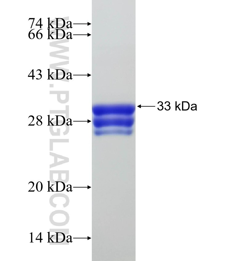 SCAMP5 fusion protein Ag31837 SDS-PAGE