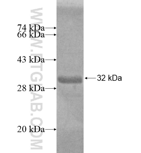 SCAND1 fusion protein Ag11257 SDS-PAGE