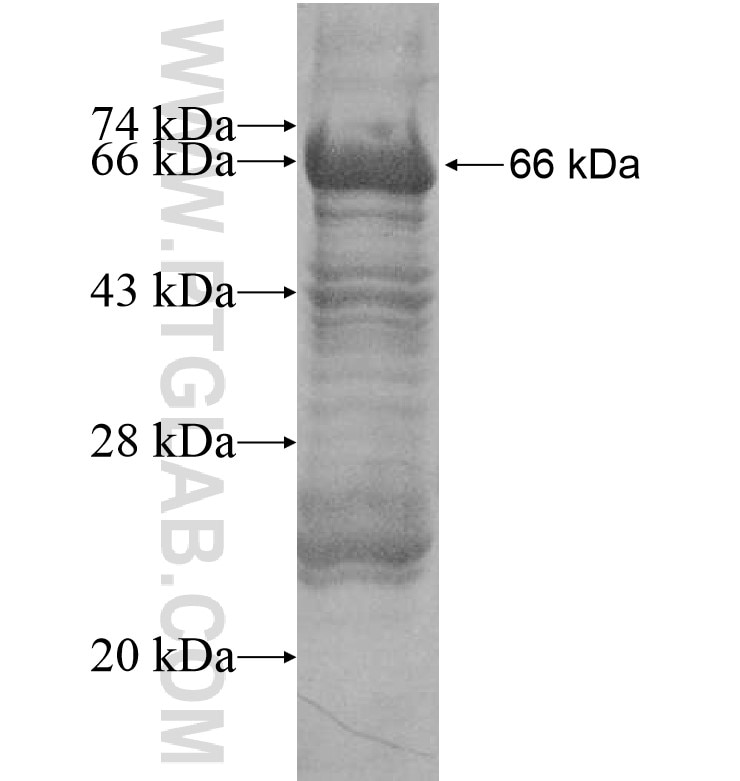 SCAND3 fusion protein Ag16480 SDS-PAGE SCAND3 fusion protein Ag16480 SDS-PAGE