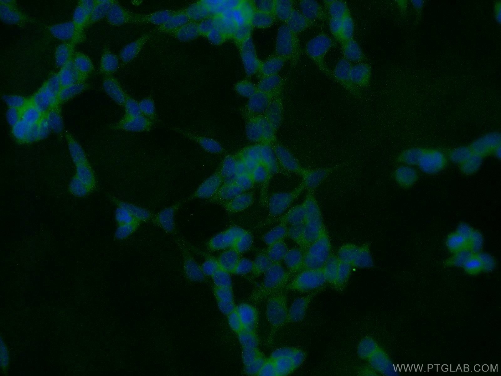 Immunofluorescence (IF) / fluorescent staining of HEK-293 cells using SCAP Polyclonal antibody (12266-1-AP)