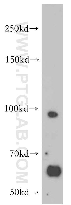 Western Blot (WB) analysis of K-562 cells using SCAP Polyclonal antibody (12266-1-AP)