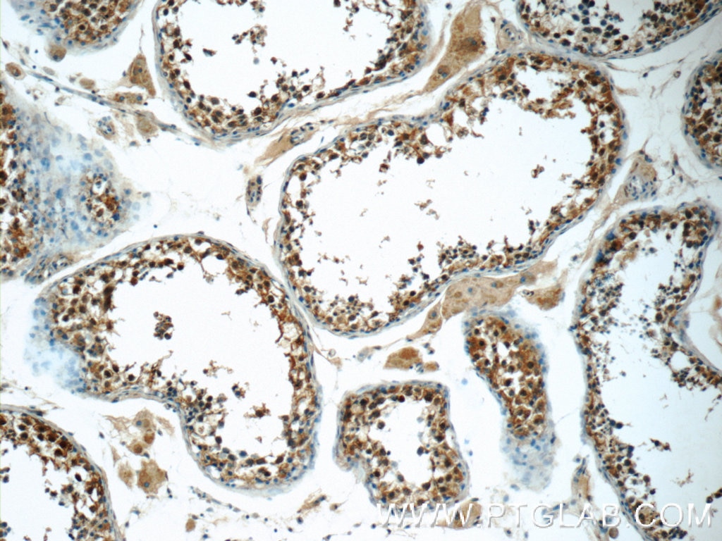 Immunohistochemistry (IHC) staining of human testis tissue using SCAPER Polyclonal antibody (16994-1-AP)