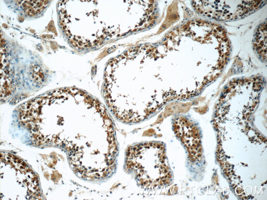 IHC staining of human testis using 16994-1-AP