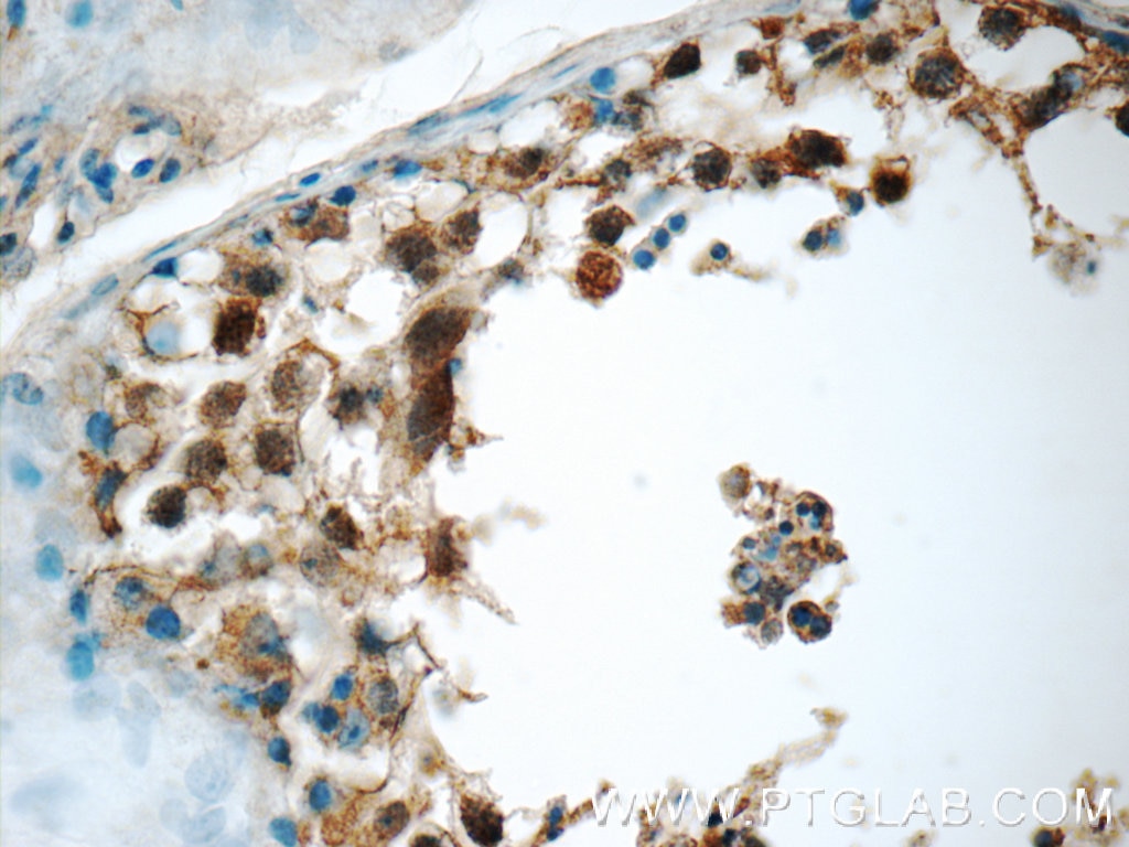 Immunohistochemistry (IHC) staining of human testis tissue using SCAPER Polyclonal antibody (16994-1-AP)