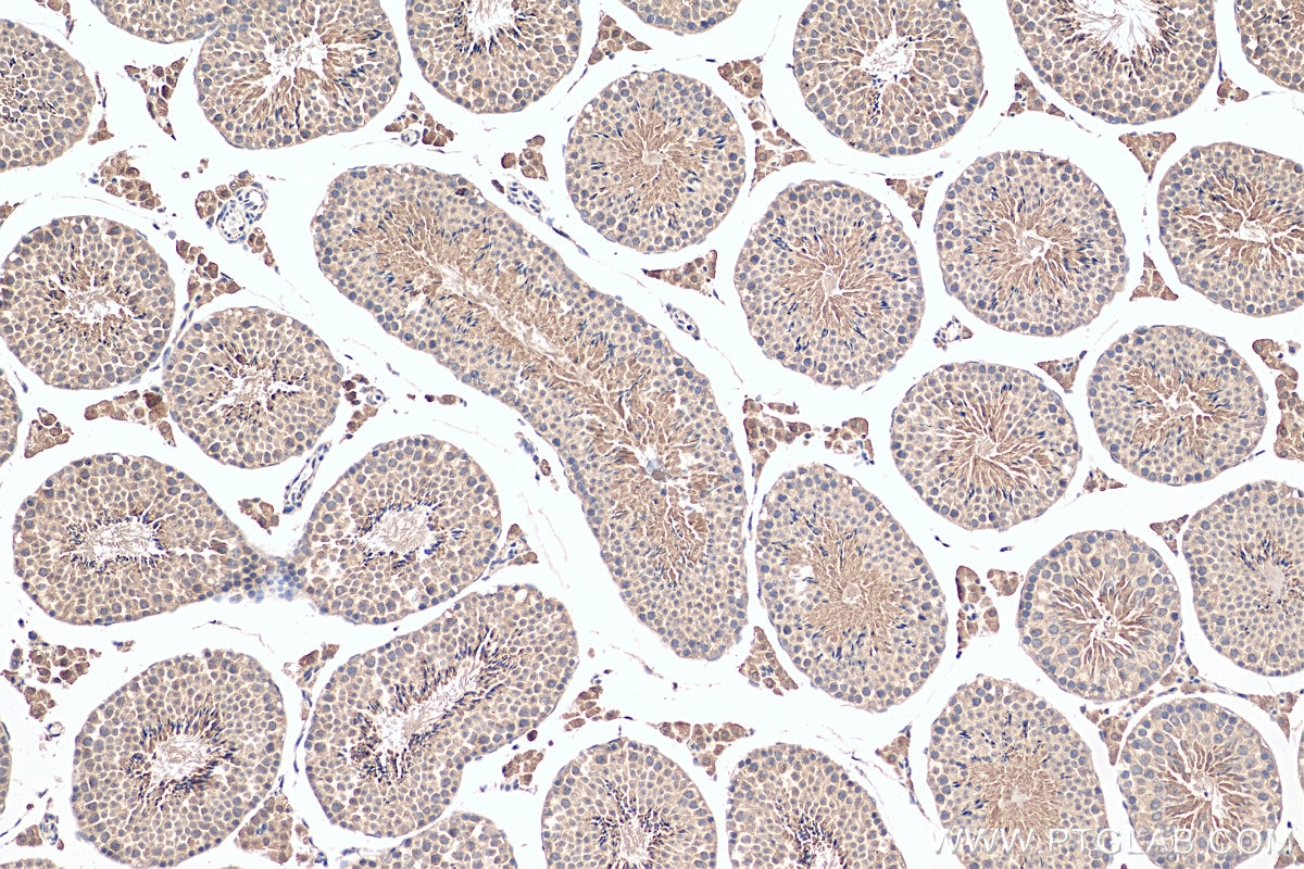 Immunohistochemistry (IHC) staining of mouse testis tissue using SCAPER Polyclonal antibody (16994-1-AP)