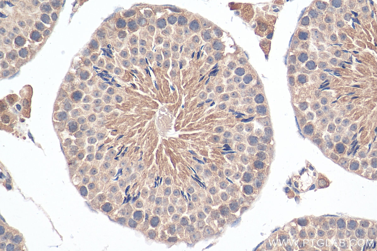 Immunohistochemistry (IHC) staining of mouse testis tissue using SCAPER Polyclonal antibody (16994-1-AP)