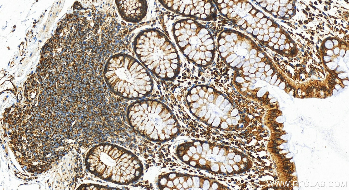 Immunohistochemistry (IHC) staining of human colon tissue using RPS4X Polyclonal antibody (14799-1-AP)