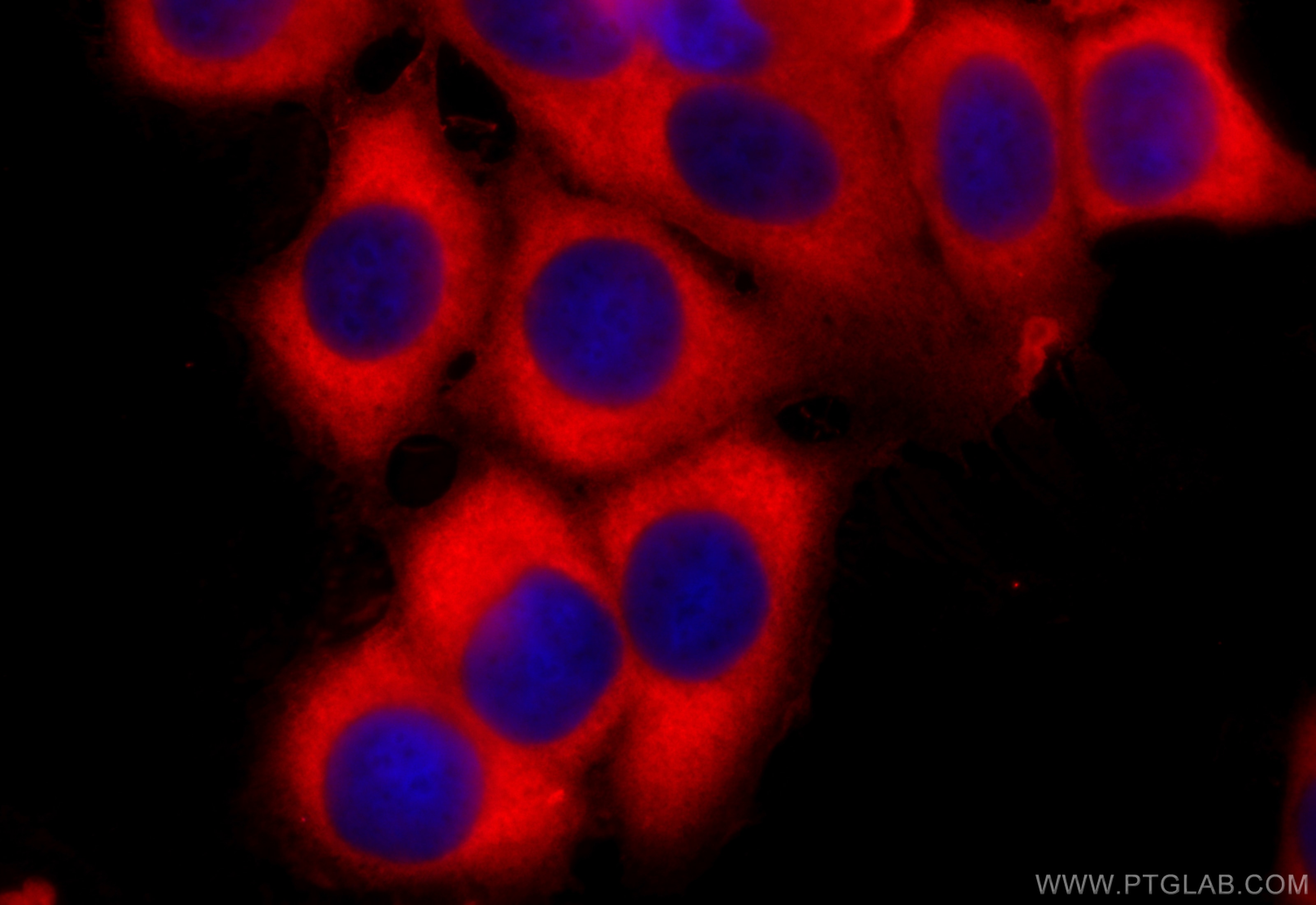 Immunofluorescence (IF) / fluorescent staining of MCF-7 cells using RPS4X Polyclonal antibody (14799-1-AP)