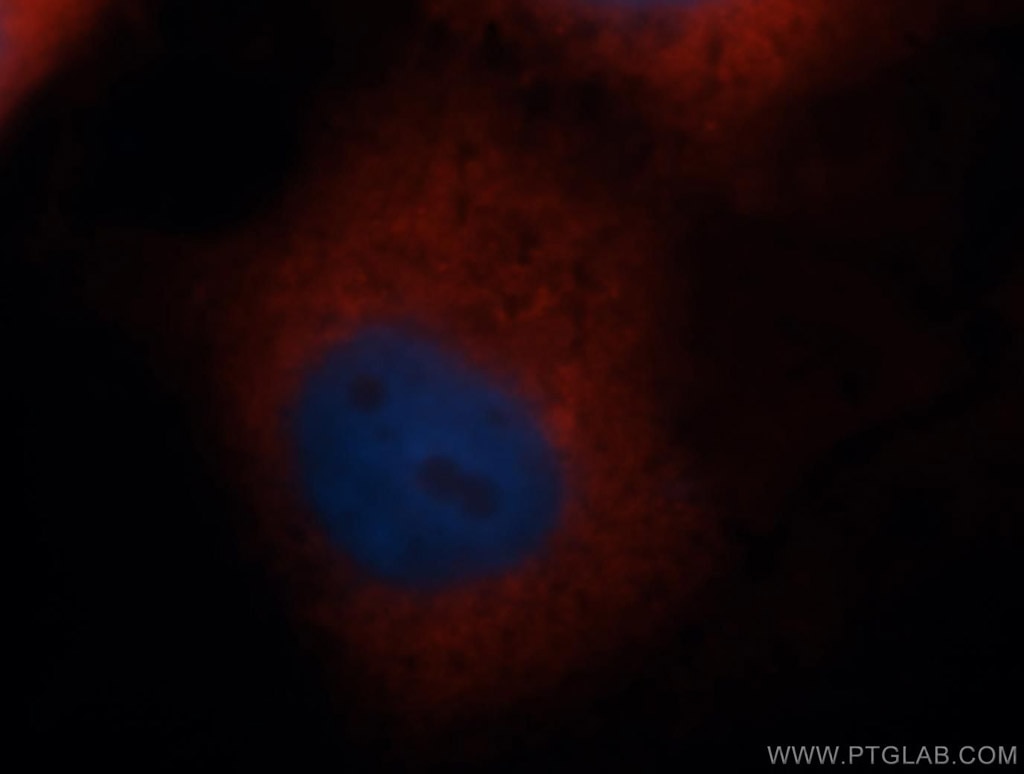 Immunofluorescence (IF) / fluorescent staining of MCF-7 cells using RPS4X Polyclonal antibody (14799-1-AP)