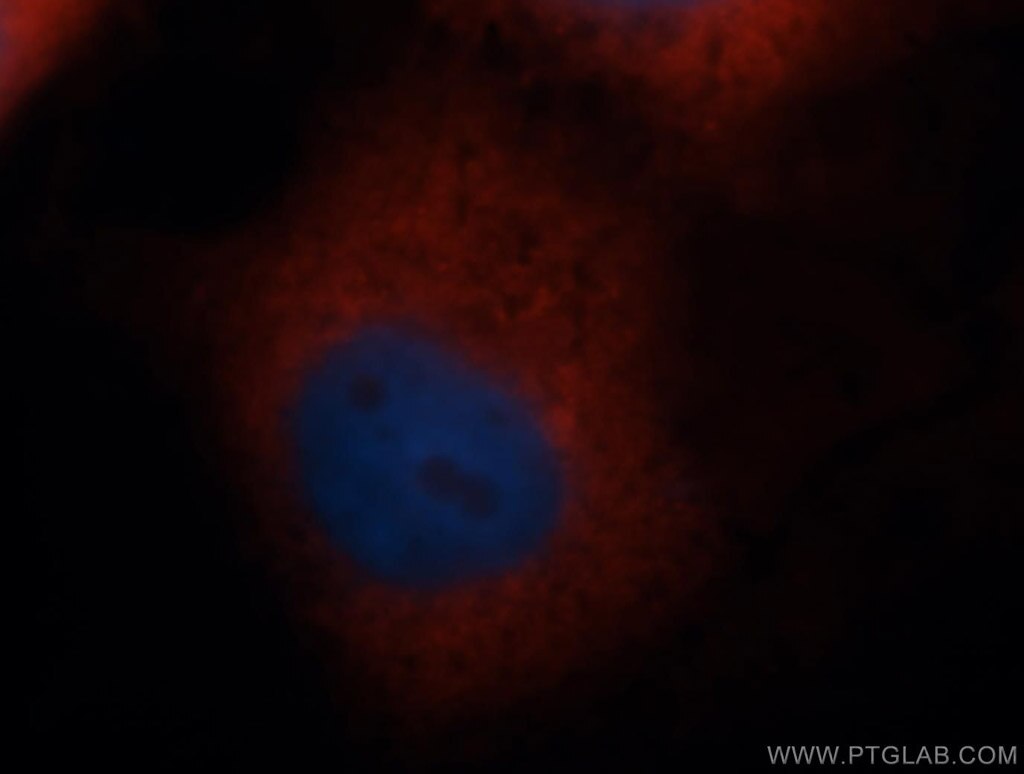 IF Staining of MCF-7 using 14799-1-AP