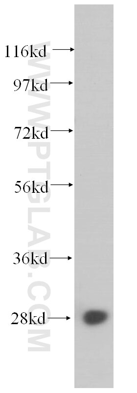 Western Blot (WB) analysis of human liver tissue using RPS4X Polyclonal antibody (14799-1-AP)