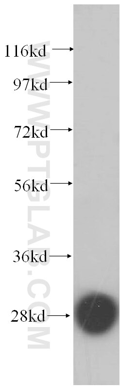 Western Blot (WB) analysis of MCF-7 cells using RPS4X Polyclonal antibody (14799-1-AP)