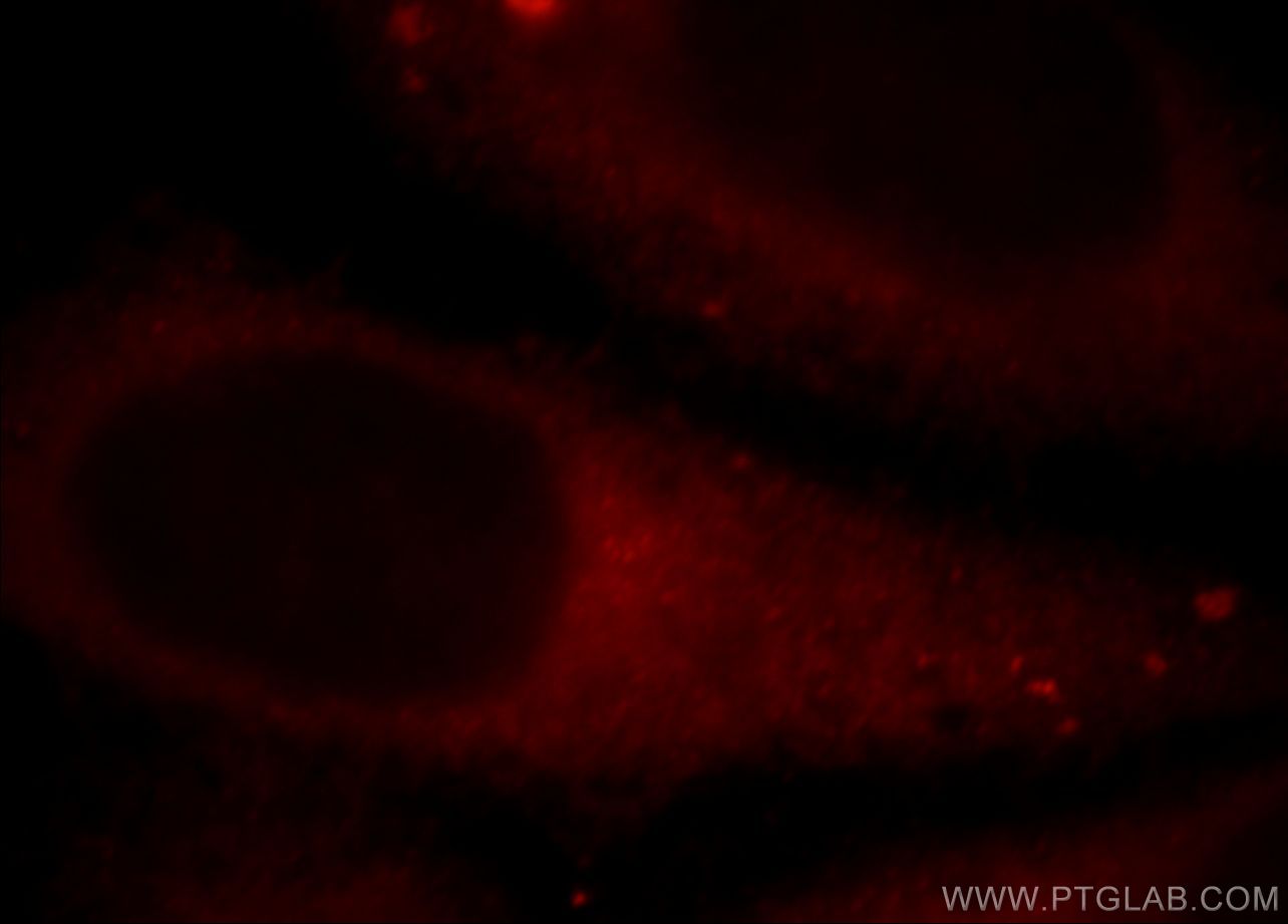 SR-BI Polyclonal antibody