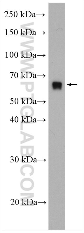 Western Blot (WB) analysis of mouse liver tissue using SR-BI Polyclonal antibody (21277-1-AP)