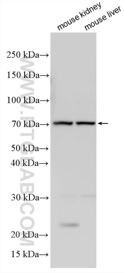 Western Blot (WB) analysis of various lysates using SR-BI Polyclonal antibody (21277-1-AP)