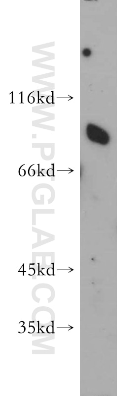 Western Blot (WB) analysis of human brain tissue using SR-BI Polyclonal antibody (21277-1-AP)