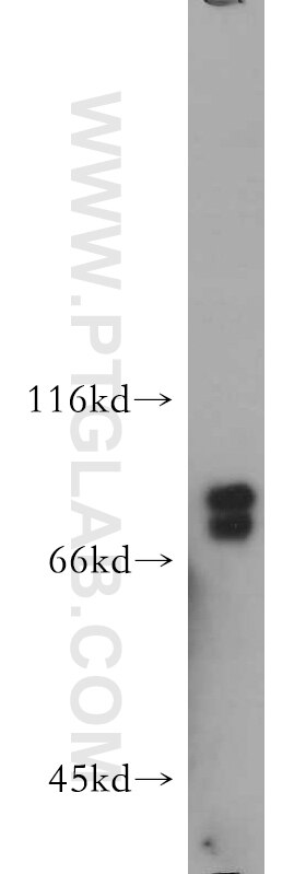 Western Blot (WB) analysis of human testis tissue using SR-BI Polyclonal antibody (21277-1-AP)