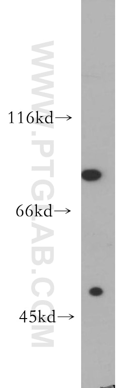 Western Blot (WB) analysis of HepG2 cells using SR-BI Polyclonal antibody (21277-1-AP)