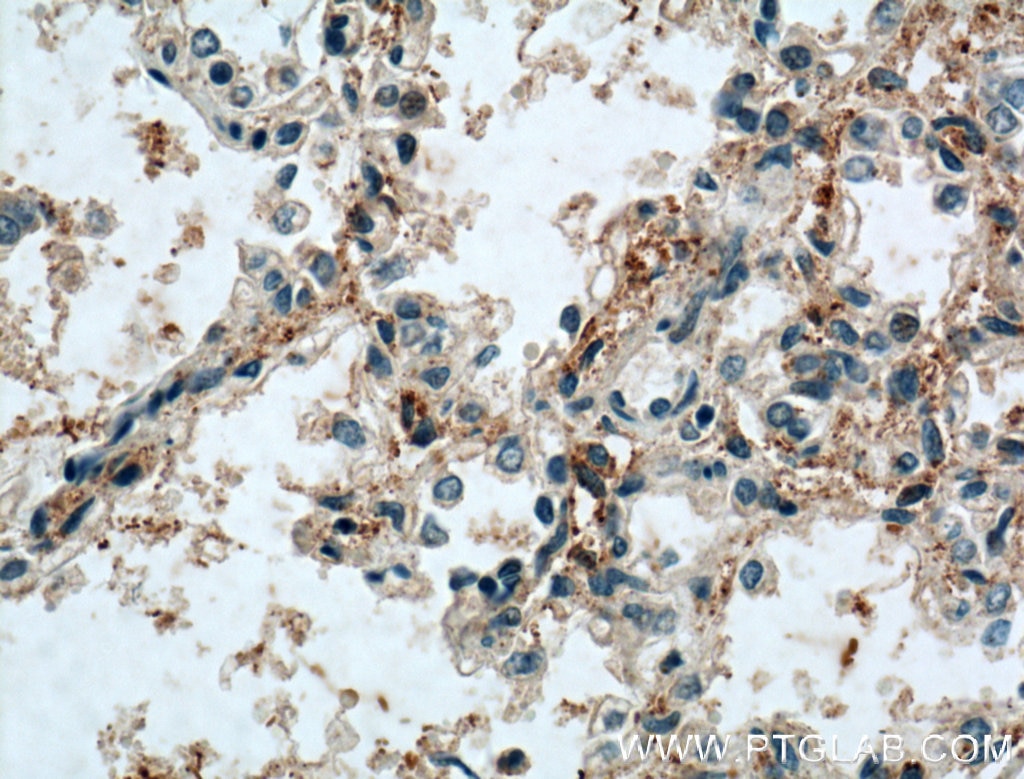 IHC staining of human lung using 13702-1-AP