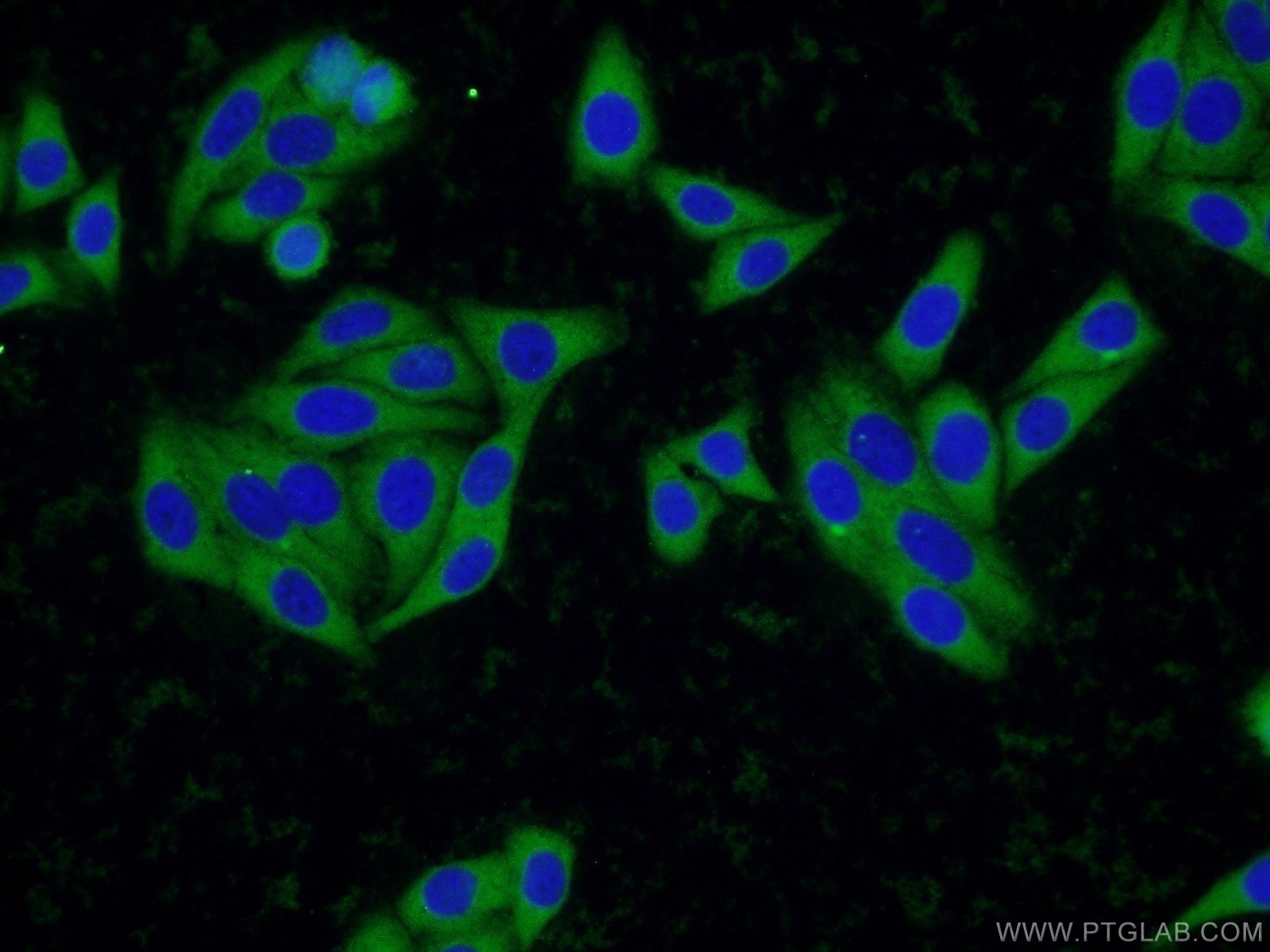 IF Staining of HepG2 using 24941-1-AP