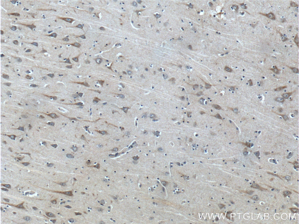 Immunohistochemistry (IHC) staining of human brain tissue using SCD Polyclonal antibody (23393-1-AP)