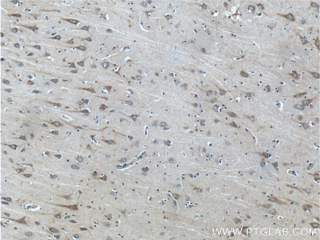 IHC staining of human brain using 23393-1-AP