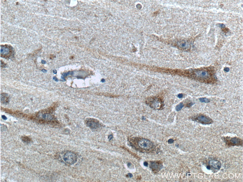 Immunohistochemistry (IHC) staining of human brain tissue using SCD Polyclonal antibody (23393-1-AP)
