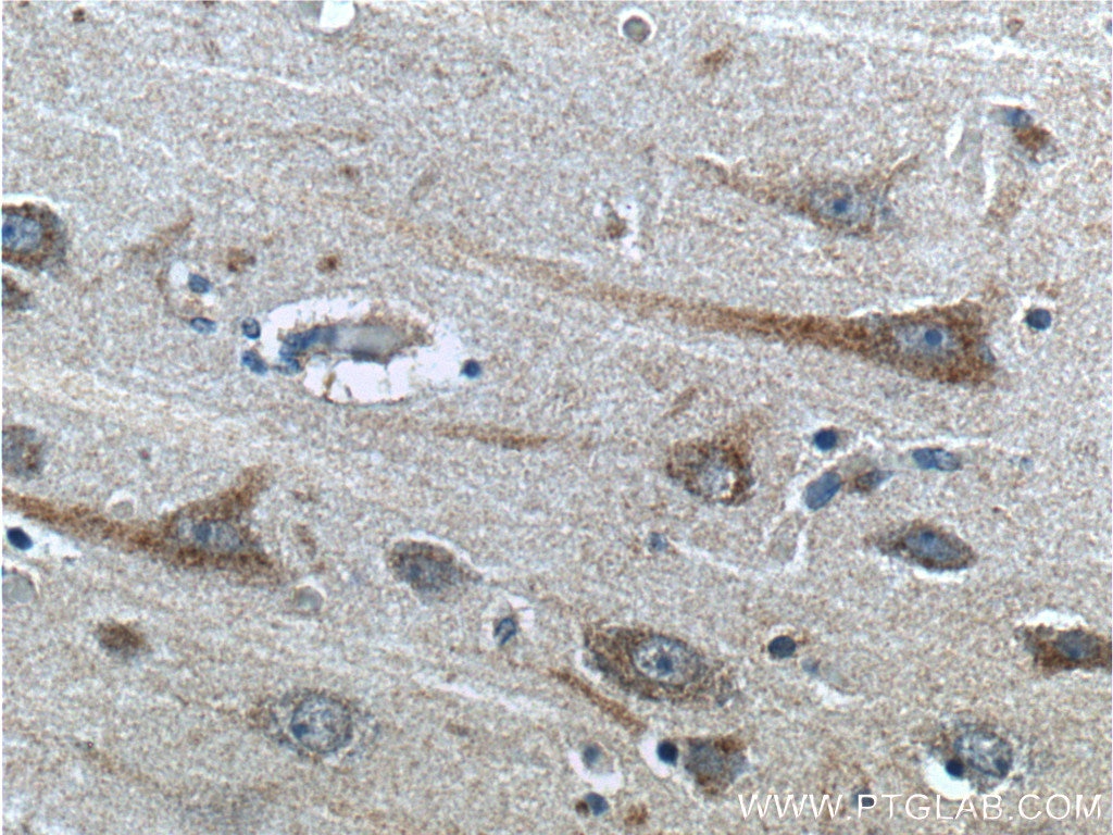 IHC staining of human brain using 23393-1-AP