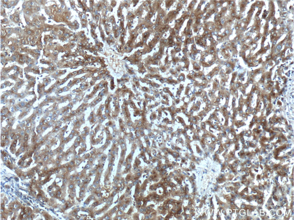 Immunohistochemistry (IHC) staining of human liver tissue using SCD Polyclonal antibody (23393-1-AP)