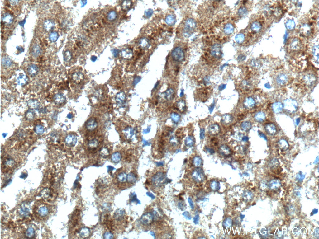 Immunohistochemistry (IHC) staining of human liver tissue using SCD Polyclonal antibody (23393-1-AP)
