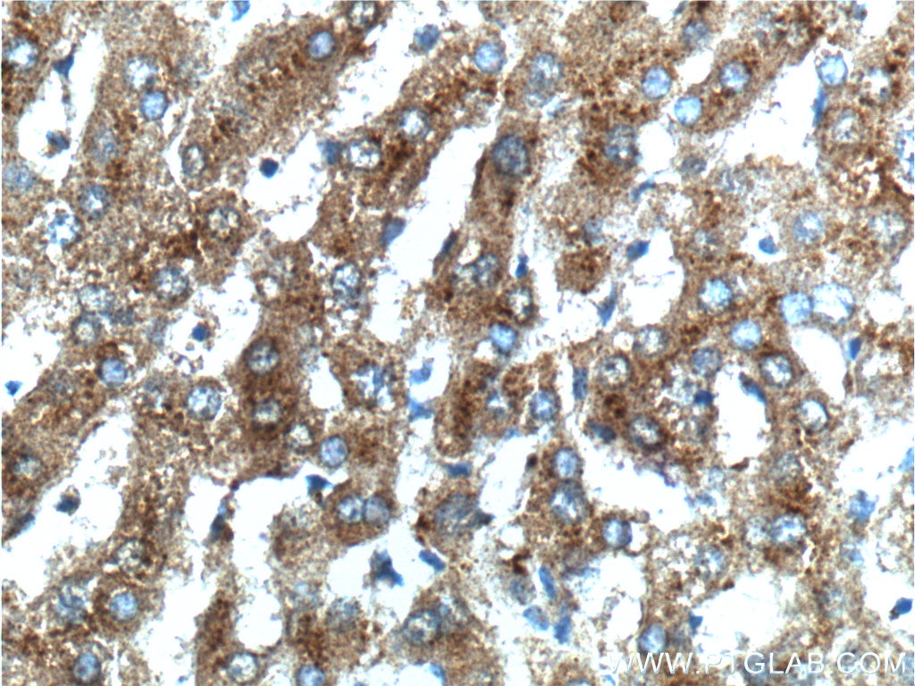 SCD Polyclonal antibody