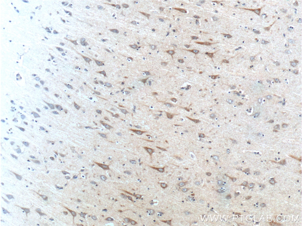 IHC staining of human brain using 23393-1-AP