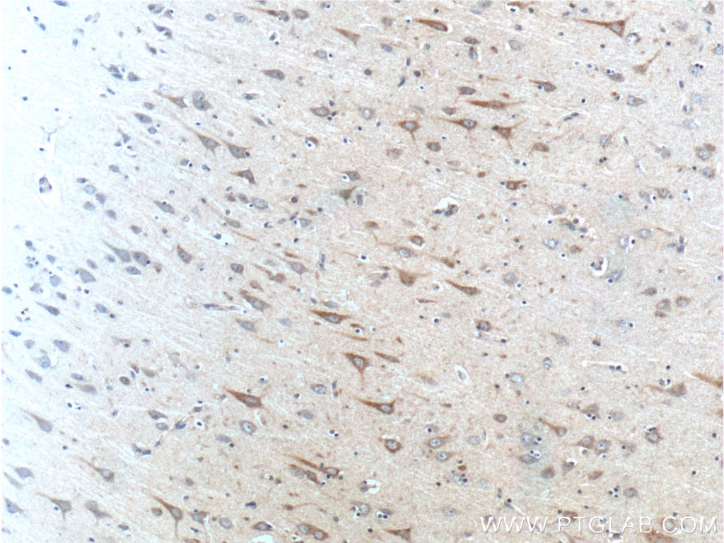 Immunohistochemistry (IHC) staining of human brain tissue using SCD Polyclonal antibody (23393-1-AP)