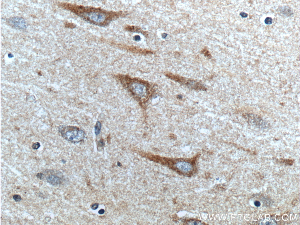 Immunohistochemistry (IHC) staining of human brain tissue using SCD Polyclonal antibody (23393-1-AP)