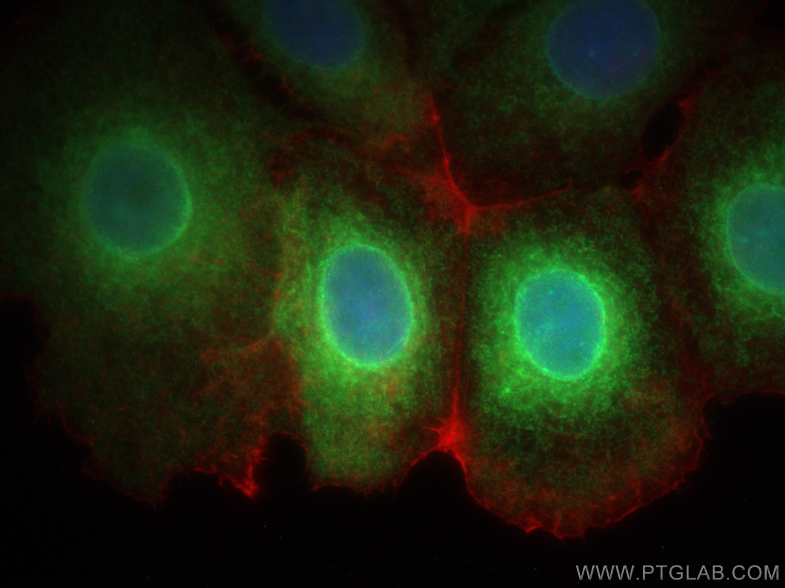Immunofluorescence (IF) / fluorescent staining of MCF-7 cells using SCD Polyclonal antibody (28678-1-AP)
