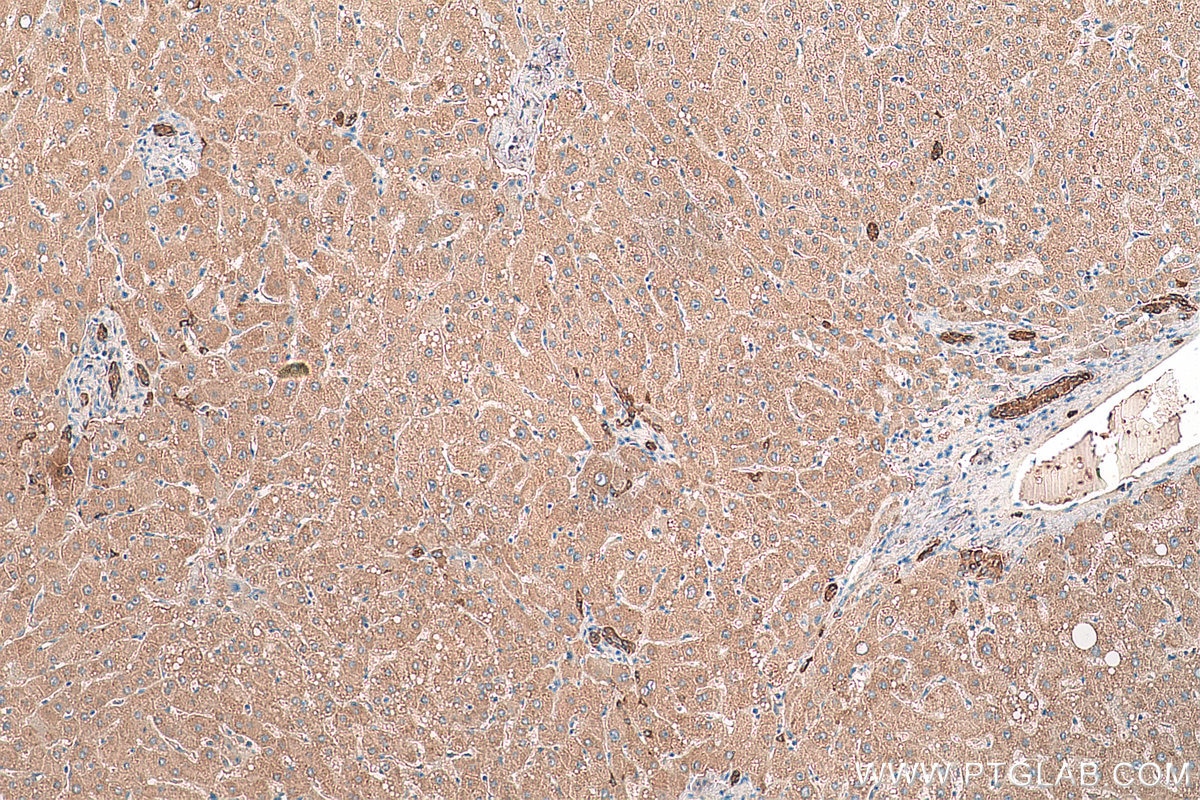 Immunohistochemistry (IHC) staining of human liver tissue using SCD Polyclonal antibody (28678-1-AP)