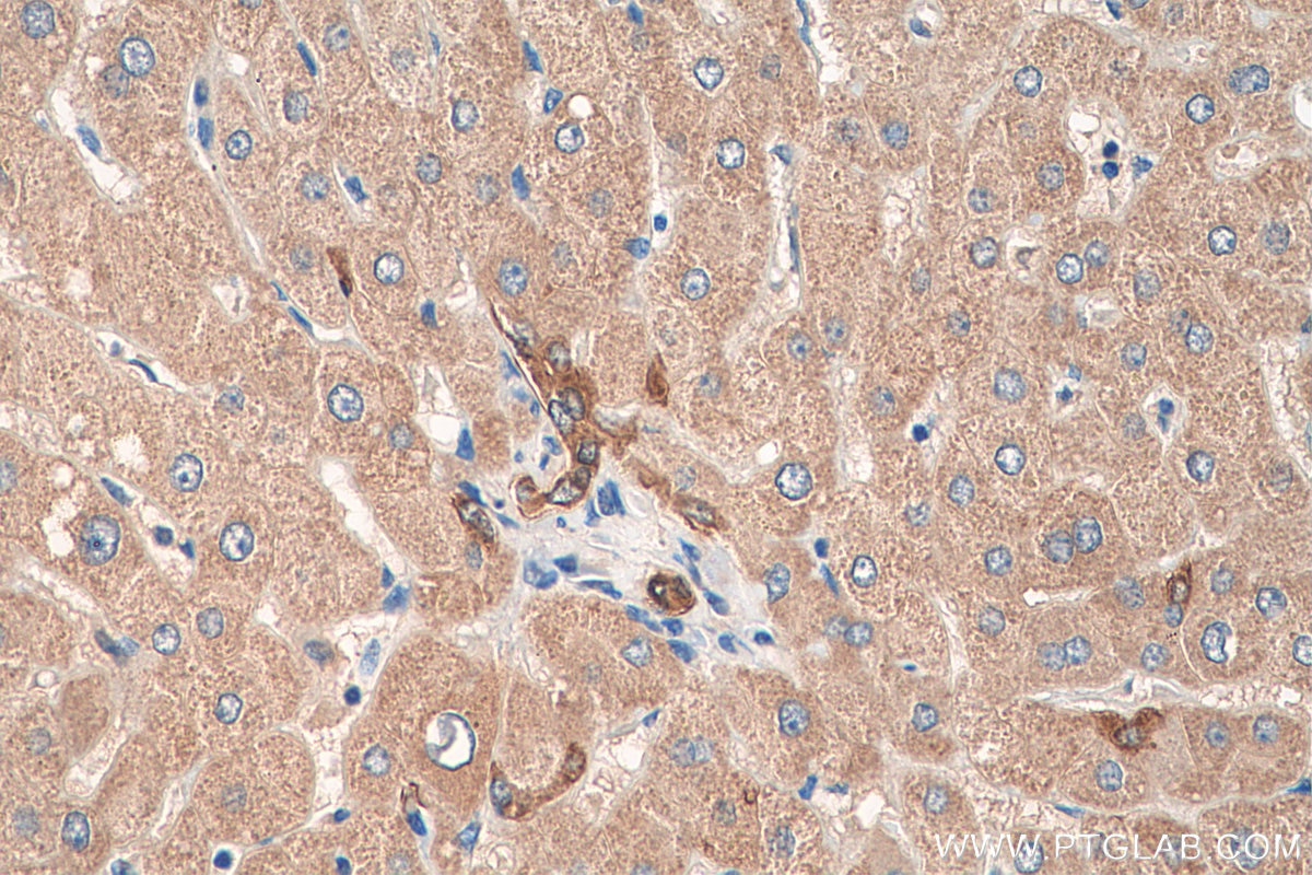 Immunohistochemistry (IHC) staining of human liver tissue using SCD Polyclonal antibody (28678-1-AP)