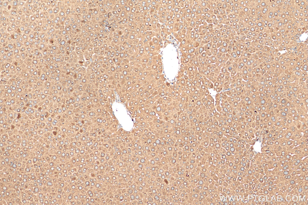 Immunohistochemistry (IHC) staining of mouse liver tissue using SCD Polyclonal antibody (28678-1-AP)