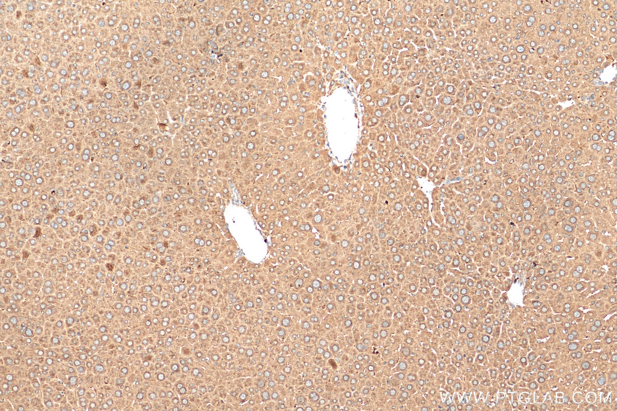 IHC staining of mouse liver using 28678-1-AP