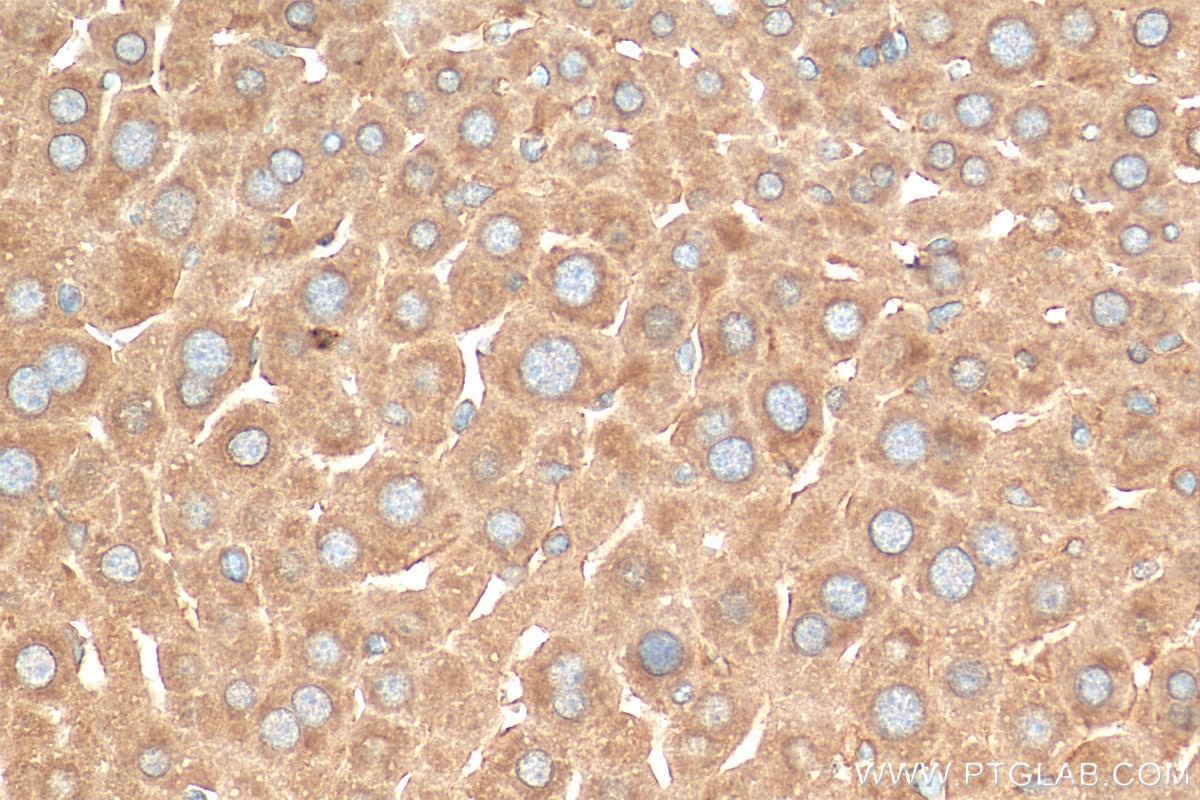 Immunohistochemistry (IHC) staining of mouse liver tissue using SCD Polyclonal antibody (28678-1-AP)