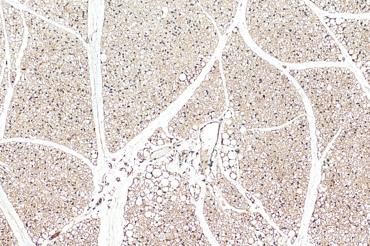 Immunohistochemistry (IHC) staining of mouse brown adipose tissue using SCD Polyclonal antibody (28678-1-AP)