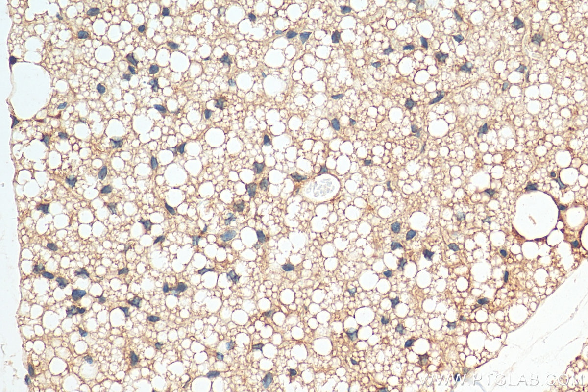Immunohistochemistry (IHC) staining of mouse brown adipose tissue using SCD Polyclonal antibody (28678-1-AP)