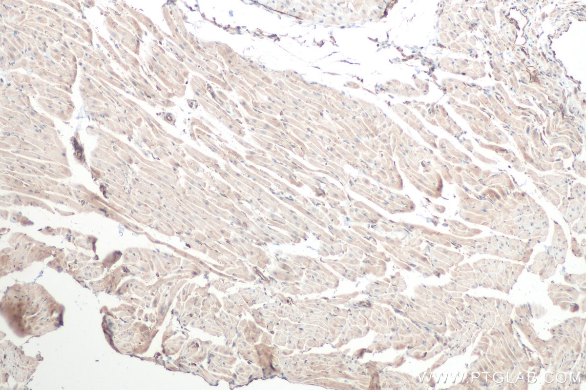 Immunohistochemistry (IHC) staining of rat heart tissue using SCD Polyclonal antibody (28678-1-AP)