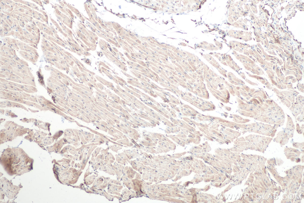 IHC staining of rat heart using 28678-1-AP