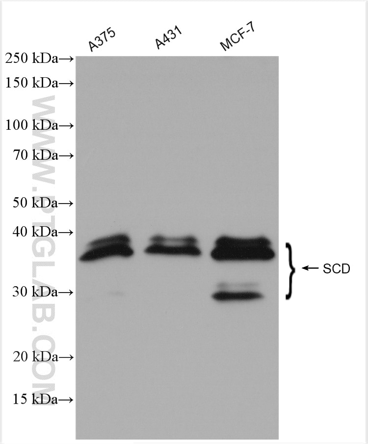 SCD