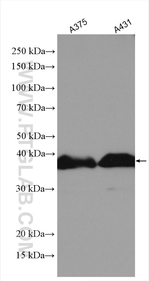 Western Blot (WB) analysis of various lysates using SCD Polyclonal antibody (28678-1-AP)
