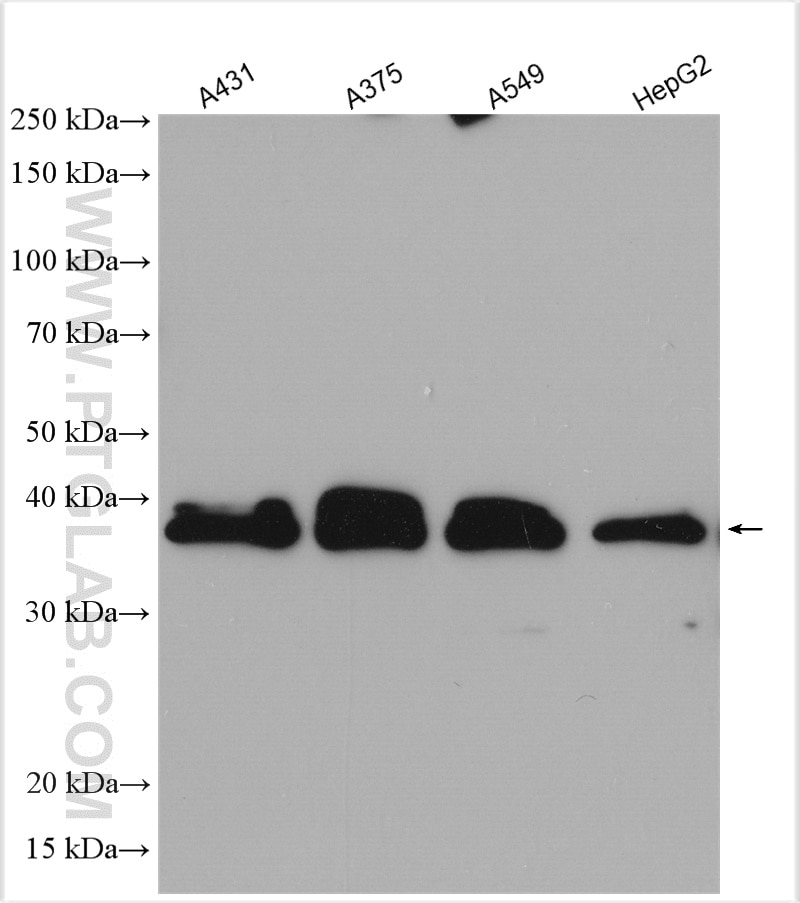 Western Blot (WB) analysis of various lysates using SCD Polyclonal antibody (28678-1-AP)