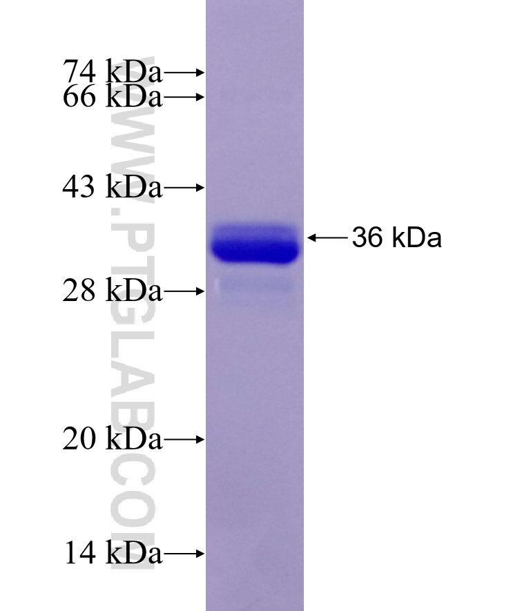 SCD fusion protein Ag29156 SDS-PAGE