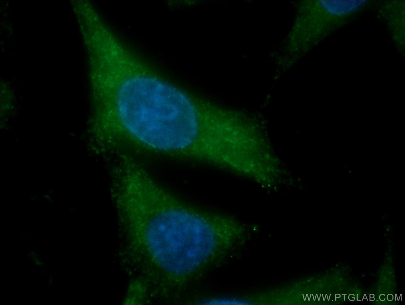 Immunofluorescence (IF) / fluorescent staining of HepG2 cells using SCEL Polyclonal antibody (11906-1-AP)